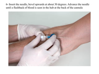 6- Insert the needle, bevel upwards at about 30 degrees. Advance the needle
until a flashback of blood is seen in the hub at the back of the cannula
 
