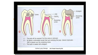 pulp therapy of primary teeth | PDF