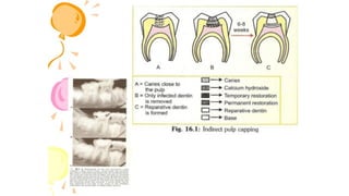pulp therapy of primary teeth | PDF