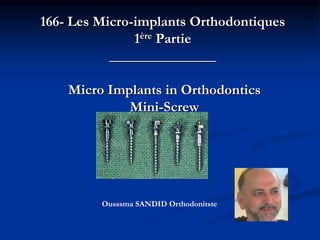 166- Les Micro-implants Orthodontiques
1ère Partie
_______________
Micro Implants in Orthodontics
Mini-Screw
Part I
Ousssma SANDID Orthodonitste
 