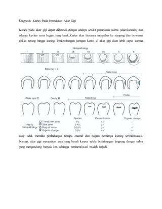 Diagnosis Karies Pada Permukaan Akar Gigi
Karies pada akar gigi dapat dideteksi dengan adanya sedikit perubahan warna (discoloration) dan
adanya kavitas serta bagian yang lunak.Karies akar biasanya menyebar ke samping dan berwarna
coklat terang hingga kuning. Perkembangan jaringan karies di akar gigi akan lebih cepat karena
akar tidak memiliki perlindungan berupa enamel dan bagian dentinnya kurang termineralisasi.
Namun, akar gigi merupakan area yang basah karena selalu berhubungan langsung dengan saliva
yang mengandung banyak ion, sehingga remineralisasi mudah terjadi.
 
