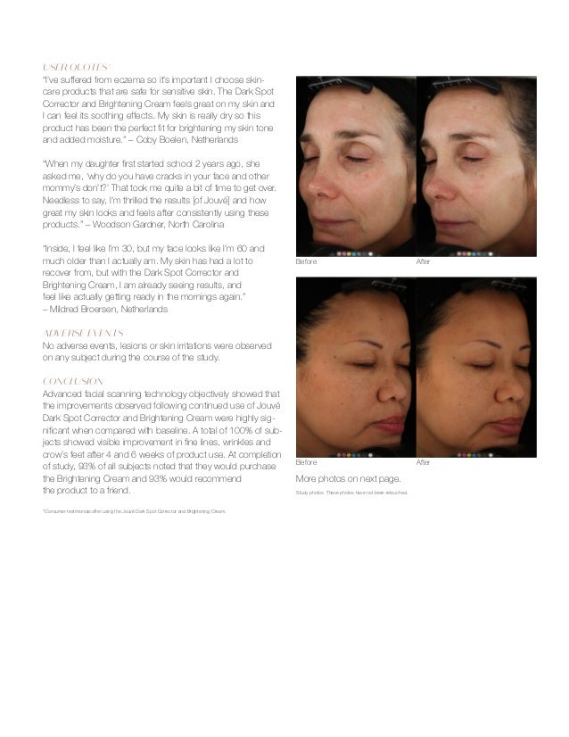 Jouve Presentation 2017