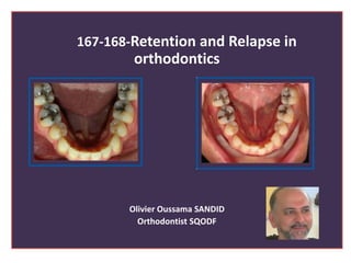 167-168-Retention and Relapse in
orthodontics
Olivier Oussama SANDID
Orthodontist SQODF
 