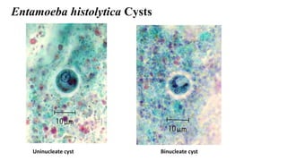 Entamoeba histolytica Cysts
Uninucleate cyst Binucleate cyst
 