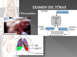 semiologia del torax y pulmones.pptx