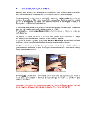 VVVV.... TTTTééééccccnnnniiiiccccaaaa ddddeeee aaaapppplllliiiiccccaaaaççççããããoooo ddddoooo LLLLAAAASSSSEEEERRRR 
Oshiro (1989), entre outros, demonstraram que melhor e mais profunda penetração da luz 
LASER é obtida quando este é aplicado em contato direto com a pele ou mucosa. 
Sempre que possível, recomenda-se a aplicação na pele com lllliiiiggggeeeeiiiirrrraaaa pppprrrreeeessssssssããããoooo de maneira que 
crie uma depressão de 0,5 a 1 cm e para afastar o sangue logo abaixo da superfície tratada, 
já que a hemoglobina age como uma barreira mecânica à penetração do LASER (a 
hemoglobina absorve facilmente o LASER). 
A região deve estar lllliiiimmmmppppaaaa, devendo-se remover ao máximo suor, cremes e pelos em excesso, 
para que não haja barreira mecânica à penetração do LASER. 
Deve-se aplicar a caneta ppppeeeerrrrppppeeeennnnddddiiiiccccuuuullllaaaarrrrmmmmnnnneeeetttteeee à pele, minimizando ao máximo as perdas por 
reflexão da luz. 
As sessões não devem ser diárias, já que cada dose aplicada pode se sobrepor ao vestígio 
da dose aplicada anteriormente, podendo causar um efeito negativo. 
O número de sessões indicadas seria entre 2222 aaaa 3333 vvvveeeezzzzeeeessss ppppoooorrrr sssseeeemmmmaaaannnnaaaa. No tratamento de casos 
crônicos a primeira sessão de aplicação pode aumentar a sensação dolorosa. 
Também é ideal que a caneta fique posicionada para baixo (no sentido vertical de 
posicionamento da caneta) ou para o lado (posicionamento lateral ou inclinado da caneta), 
como visto nas fotos abaixo: 
Deve-se eeeevvvviiiittttaaaarrrr utilizá-la com a extremidade virada para cima, o que pode causar danos ao 
diodo LASER por entrada ou acúmulo de qualquer tipo de resíduo ou substância pela 
abertura da caneta. 
CCCCUUUUIIIIDDDDAAAADDDDOOOO:::: EEEEVVVVIIIITTTTEEEE SSSSEEEEMMMMPPPPRRRREEEE OOOOLLLLHHHHAAAARRRR DDDDIIIIRRRREEEETTTTAAAAMMMMEEEENNNNTTTTEEEE PPPPAAAARRRRAAAA AAAA SSSSAAAAÍÍÍÍDDDDAAAA DDDDOOOO LLLLAAAASSSSEEEERRRR EEEEMMMMIIIITTTTIIIIDDDDOOOO 
PPPPEEEELLLLAAAA CCCCAAAANNNNEEEETTTTAAAA,,,, MMMMEEEESSSSMMMMOOOO QQQQUUUUEEEE EEEESSSSTTTTEEEEJJJJAAAA UUUUTTTTIIIILLLLIIIIZZZZAAAANNNNDDDDOOOO ÓÓÓÓCCCCUUUULLLLOOOOSSSS DDDDEEEE PPPPRRRROOOOTTTTEEEEÇÇÇÇÃÃÃÃOOOO.... 
 