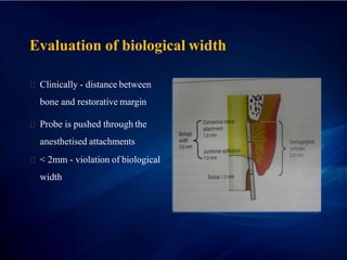 Evaluation of biological width
Clinically - distance between
bone and restorative margin
Probe is pushed through the
anesthetised attachments
< 2mm - violation of biological
width
 