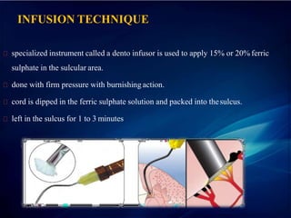 INFUSION TECHNIQUE
specialized instrument called a dento infusor is used to apply 15% or 20% ferric
sulphate in the sulcular area.
done with firm pressure with burnishing action.
cord is dipped in the ferric sulphate solution and packed into thesulcus.
left in the sulcus for 1 to 3 minutes
 