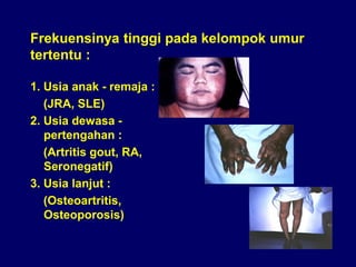 Rematism 168826173-Penanganan-Artritis-Dan-Reumatism-Slide-Komplet.pdf