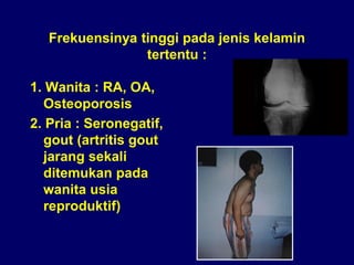 Rematism 168826173-Penanganan-Artritis-Dan-Reumatism-Slide-Komplet.pdf