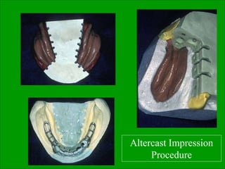 Altercast Impression
Procedure
 