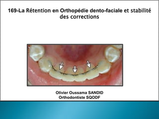 169-La Rétention en Orthopédie dento-faciale et stabilité
des corrections
Olivier Oussama SANDID
Orthodontiste SQODF
 