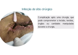 Infecção de sítio cirúrgico
Complicação após uma cirurgia, que
pode comprometer a incisão, tecidos,
órgãos ou cavidades manipuladas
durante a cirurgia.
 