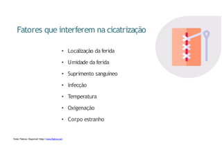 Fatores que interferem na cicatrização
• Localização da ferida
• Umidade da ferida
• Suprimento sanguíneo
• Infecção
• Temperatura
• Oxigenação
• Corpo estranho
Fonte: Flaticon. Disponível: https://www.flaticon.com
 