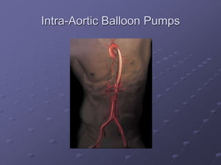 Intra-Aortic Balloon Pumps
 