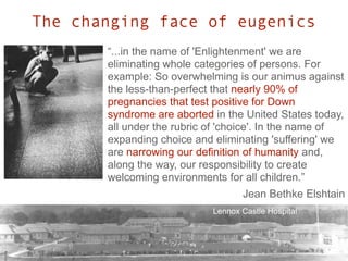 The changing face of eugenics
                         “...in the name of 'Enlightenment' we are
                         eliminating whole categories of persons. For
                         example: So overwhelming is our animus against
                         the less-than-perfect that nearly 90% of
                         pregnancies that test positive for Down
                         syndrome are aborted in the United States today,
                         all under the rubric of 'choice'. In the name of
                         expanding choice and eliminating 'suffering' we
                         are narrowing our definition of humanity and,
                         along the way, our responsibility to create
                         welcoming environments for all children.”
Christmas in Purgatory                               Jean Bethke Elshtain
                                              Lennox Castle Hospital
 
