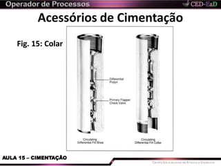 Acessórios de Cimentação
Fig. 15: Colar
AULA 15 – CIMENTAÇÃO
 