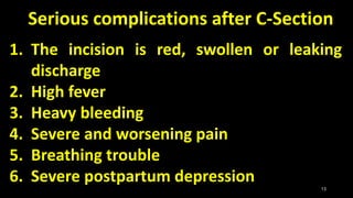 Casarean section | PPTX