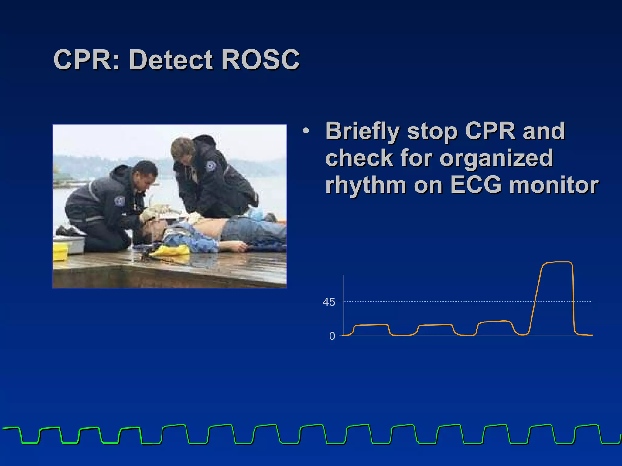 CPR: Detect ROSC Briefly stop CPR and check for organized rhythm on ECG monitor 4 5 0 