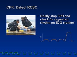 CPR: Detect ROSC Briefly stop CPR and check for organized rhythm on ECG monitor 4 5 0 