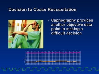 Decision to Cease Resuscitation Capnography provides another objective data point in making a difficult decision 0 2 5 