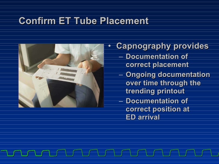 16 capnography part3 intubated
