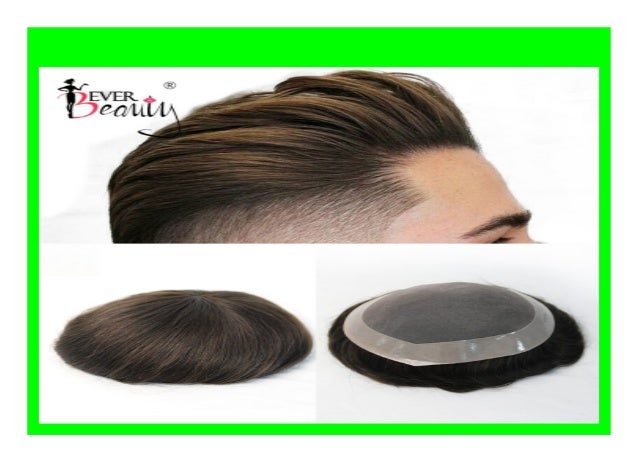 toupee hair replacement system