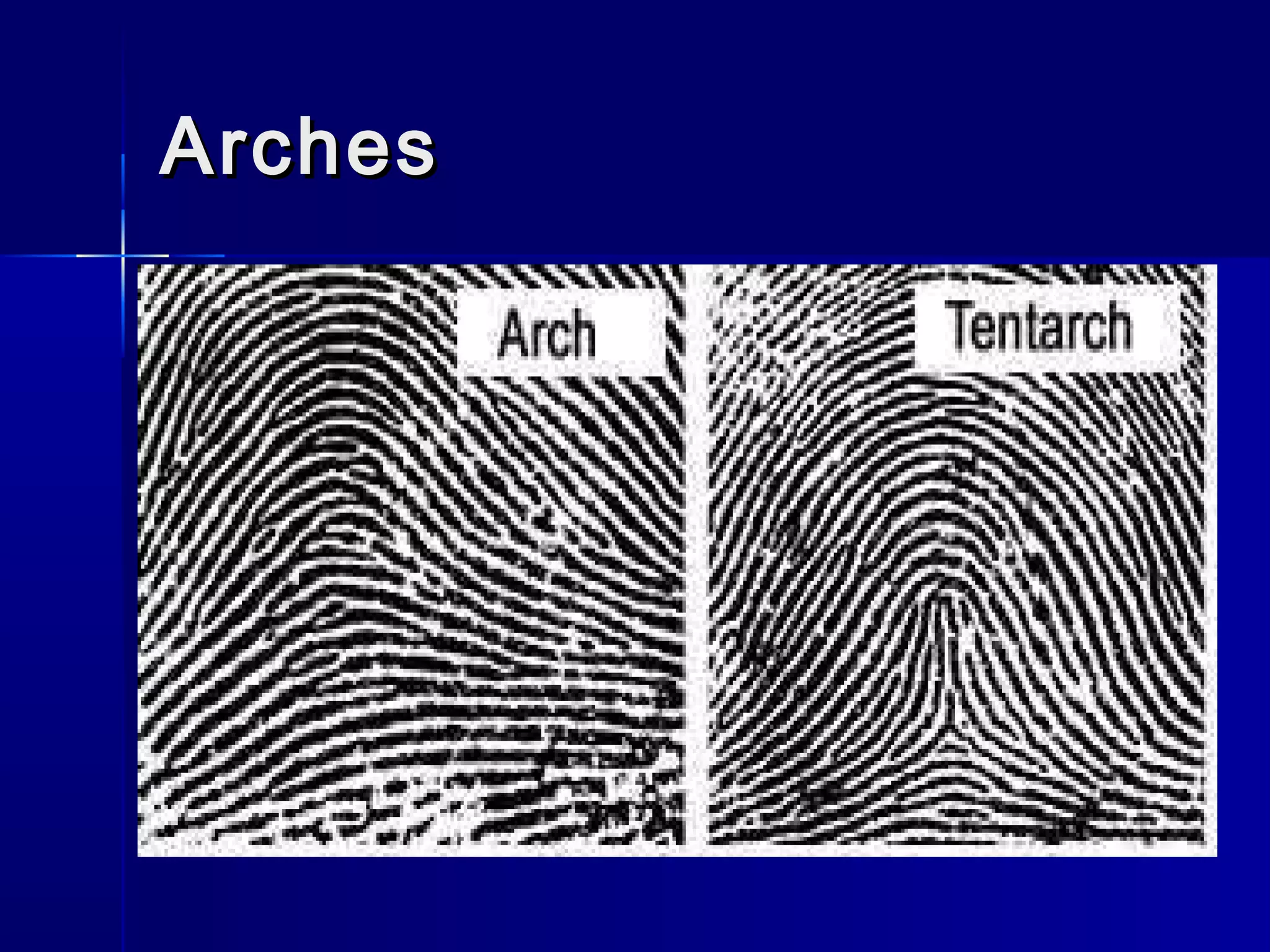 ArchesArches
 