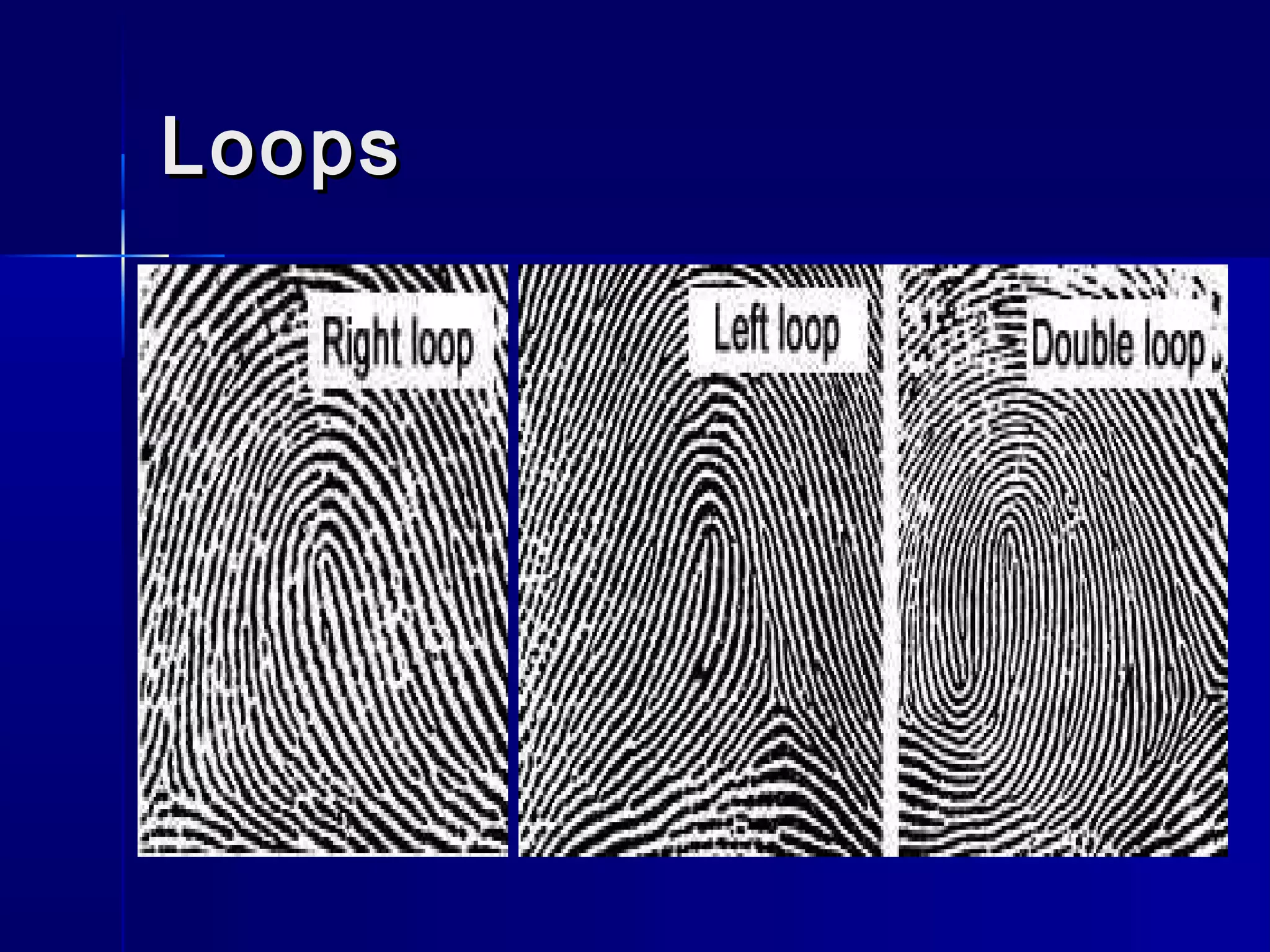 LoopsLoops
 