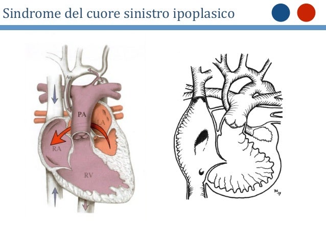 Ultrasonography di vene Tjumen fissa