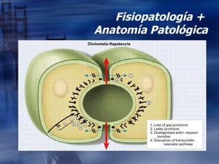 Fisiopatología +  Anatomía Patológica 