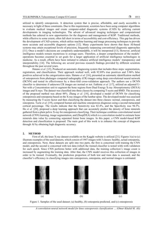 A convolution neural network model for knee osteoporosis classification ...
