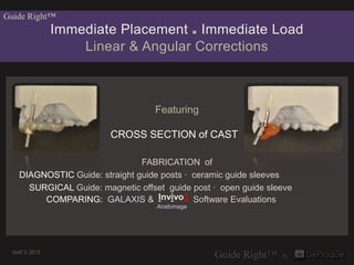 Guide Right™
                 Immediate Placement ■ Immediate Load
                     Linear & Angular Corrections



                                   Featuring

                         CROSS SECTION of CAST

                                FABRICATION of
    DIAGNOSTIC Guide: straight guide posts · ceramic guide sleeves
      SURGICAL Guide: magnetic offset guide post · open guide sleeve
         COMPARING: GALAXIS & Invivo5 Software Evaluations
                                    Anatomage




  SMIT 3..2013
 