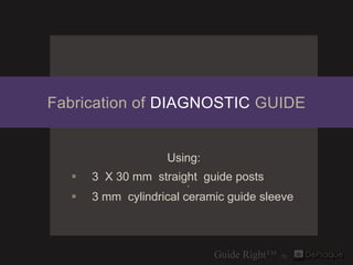 Fabrication of DIAGNOSTIC GUIDE


                   Using:
     3 X 30 mm straight guide posts
                       
...