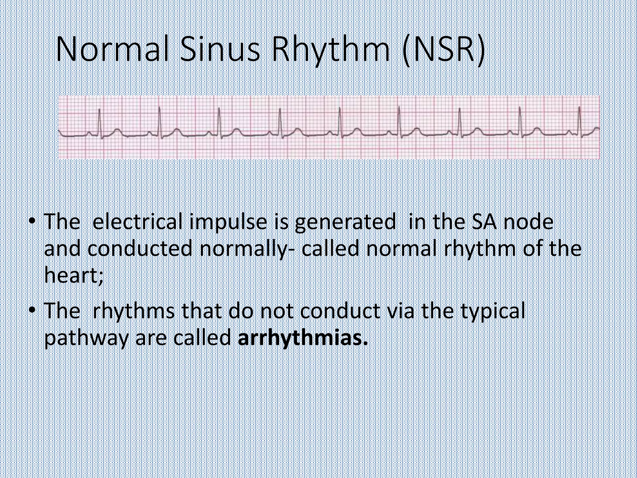 Interpretation of ECG lab session.ppt