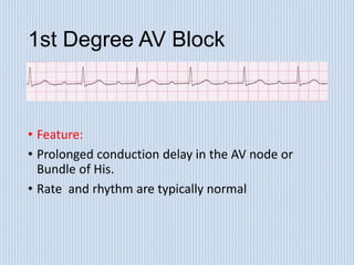 Interpretation of ECG lab session.ppt