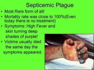Septicemic Plague Most Rare form of all! Mortality rate was close to 100%(Even today there is no treatment) Symptoms: High Fever and  skin turning deep  shades of purple! Victims usually died the same day the  symptoms appeared. 