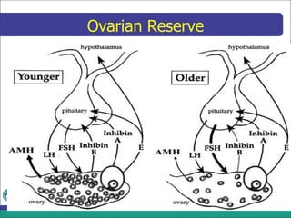Treatment of decreased ovarian reserve | PDF