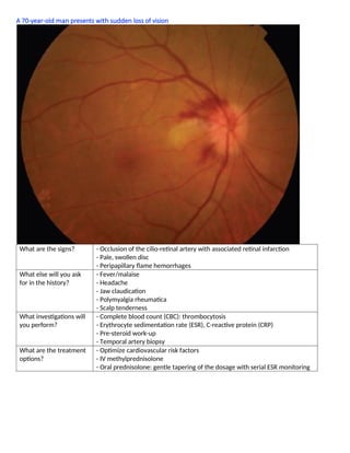 A 70-year-old man presents with sudden loss of vision
What are the signs? - Occlusion of the cilio-retinal artery with associated retinal infarction
- Pale, swollen disc
- Peripapillary ﬂame hemorrhages
What else will you ask
for in the history?
- Fever/malaise
- Headache
- Jaw claudication
- Polymyalgia rheumatica
- Scalp tenderness
What investigations will
you perform?
- Complete blood count (CBC): thrombocytosis
- Erythrocyte sedimentation rate (ESR), C-reactive protein (CRP)
- Pre-steroid work-up
- Temporal artery biopsy
What are the treatment
options?
- Optimize cardiovascular risk factors
- IV methylprednisolone
- Oral prednisolone: gentle tapering of the dosage with serial ESR monitoring
 