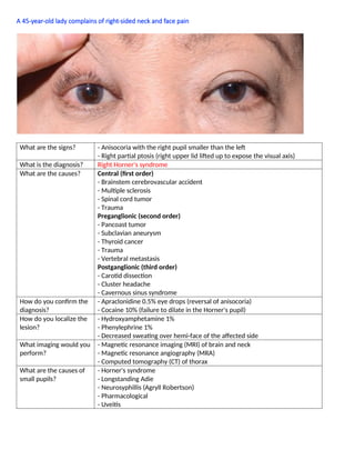 A 45-year-old lady complains of right-sided neck and face pain
What are the signs? - Anisocoria with the right pupil smaller than the left
- Right partial ptosis (right upper lid lifted up to expose the visual axis)
What is the diagnosis? Right Horner's syndrome
What are the causes? Central (ﬁrst order)
- Brainstem cerebrovascular accident
- Multiple sclerosis
- Spinal cord tumor
- Trauma
Preganglionic (second order)
- Pancoast tumor
- Subclavian aneurysm
- Thyroid cancer
- Trauma
- Vertebral metastasis
Postganglionic (third order)
- Carotid dissection
- Cluster headache
- Cavernous sinus syndrome
How do you conﬁrm the
diagnosis?
- Apraclonidine 0.5% eye drops (reversal of anisocoria)
- Cocaine 10% (failure to dilate in the Horner's pupil)
How do you localize the
lesion?
- Hydroxyamphetamine 1%
- Phenylephrine 1%
- Decreased sweating over hemi-face of the affected side
What imaging would you
perform?
- Magnetic resonance imaging (MRI) of brain and neck
- Magnetic resonance angiography (MRA)
- Computed tomography (CT) of thorax
What are the causes of
small pupils?
- Horner's syndrome
- Longstanding Adie
- Neurosyphillis (Agryll Robertson)
- Pharmacological
- Uveitis
 