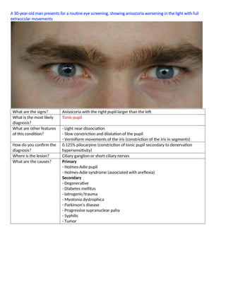 A 30-year-old man presents for a routine eye screening, showing anisocoria worsening in the light with full
extraocular movements
What are the signs? Anisocoria with the right pupil larger than the left
What is the most likely
diagnosis?
Tonic pupil
What are other features
of this condition?
- Light near dissociation
- Slow constriction and dilatation of the pupil
- Vermiform movements of the iris (constriction of the iris in segments)
How do you conﬁrm the
diagnosis?
0.125% pilocarpine (constriction of tonic pupil secondary to denervation
hypersensitivity)
Where is the lesion? Ciliary ganglion or short ciliary nerves
What are the causes? Primary
- Holmes-Adie pupil
- Holmes-Adie syndrome (associated with areﬂexia)
Secondary
- Degenerative
- Diabetes mellitus
- Iatrogenic/trauma
- Myotonia dystrophica
- Parkinson's disease
- Progressive supranuclear palsy
- Syphilis
- Tumor
 