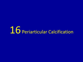 16Periarticular Calcification