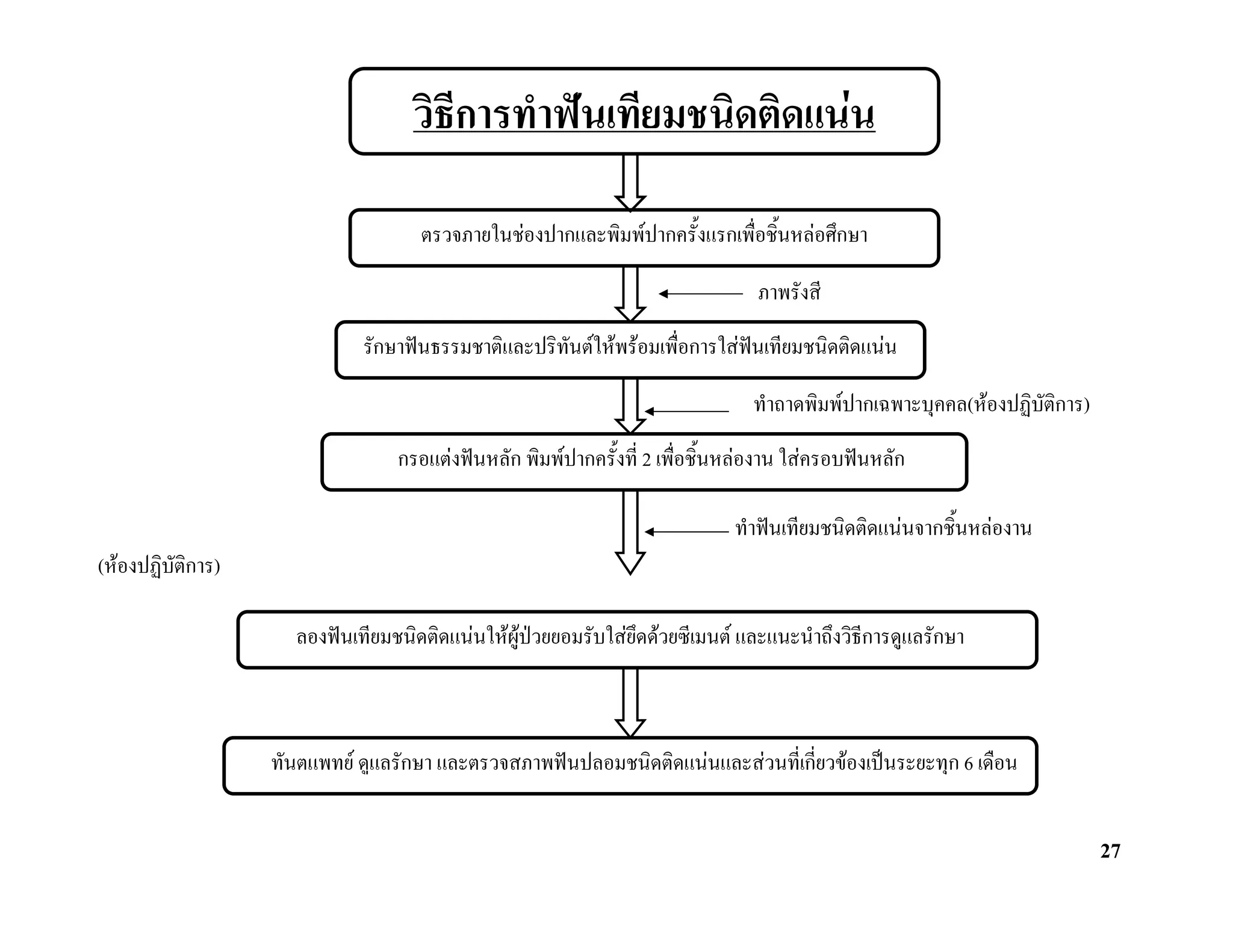 วิธีการทําฟนเทียมชนิดติดแนน

                                  ตรวจภายในชองปากและพิมพปากครั้งแรกเพื่อชิ้นหลอศึกษา

                                                                             ภาพรังสี
                           รักษาฟนธรรมชาติและปริทันตใหพรอมเพื่อการใสฟนเทียมชนิดติดแนน

                                                                            ทําถาดพิมพปากเฉพาะบุคคล(หองปฏิบัติการ)
                               กรอแตงฟนหลัก พิมพปากครั้งที่ 2 เพื่อชิ้นหลองาน ใสครอบฟนหลัก

                                                                          ทําฟนเทียมชนิดติดแนนจากชิ้นหลองาน
(หองปฏิบตการ)
         ัิ

                   ลองฟนเทียมชนิดติดแนนใหผูปวยยอมรับใสยึดดวยซีเมนต และแนะนําถึงวิธีการดูแลรักษา



                 ทันตแพทย ดูแลรักษา และตรวจสภาพฟนปลอมชนิดติดแนนและสวนที่เกี่ยวของเปนระยะทุก 6 เดือน


                                                                                                                       27
 