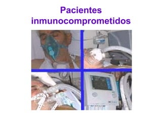 Pacientes
inmunocomprometidos
 