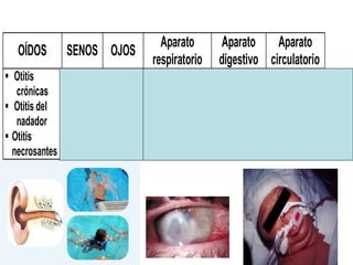 OÍDOS SENOS OJOS
Aparato
respiratorio
Aparato
digestivo
Aparato
circulatorio
 Otitis
crónicas
 Otitis del
nadador
 Otitis
necrosantes
Sinusitis
Cronicas
Queratitis
(uso de
lentes de
contato)
Neumonías
(hospitalizados)
Enterocolitis
pseudomenb
ranosa
Endocarditis
(drogadictos
transplantado
o con
válvulas)
 