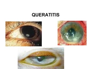 QUERATITIS
 
