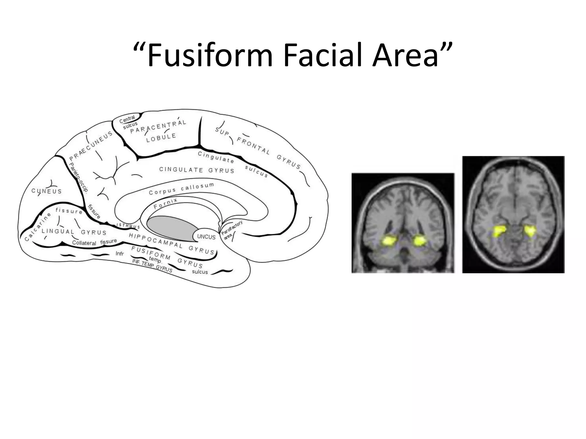 “Fusiform Facial Area”
 