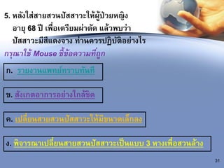 5. หลังใส่สายสวนปัสสาวะให้ผู้ป่วยหญิง
อายุ 68 ปี เพื่อเตรียมผ่าตัด แล้วพบว่า
ปัสสาวะมีสีแดงจาง ท่านควรปฏิบัติอย่างไร
กรุณาใช้ Mouse ชี้ข้อความที่ถูก
ก. รายงานแพทย์ทราบทันที
31
ข. สังเกตอาการอย่างใกล้ชิด
ค. เปลี่ยนสายสวนปัสสาวะให้มีขนาดเล็กลง
ง. พิจารณาเปลี่ยนสายสวนปัสสาวะเป็นแบบ 3 หางเพื่อสวนล้าง
 