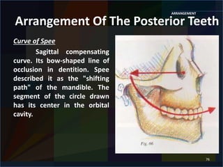 SELECTION AND ARRANGEMENT OF ARTIFICIAL TEETH | PPTX