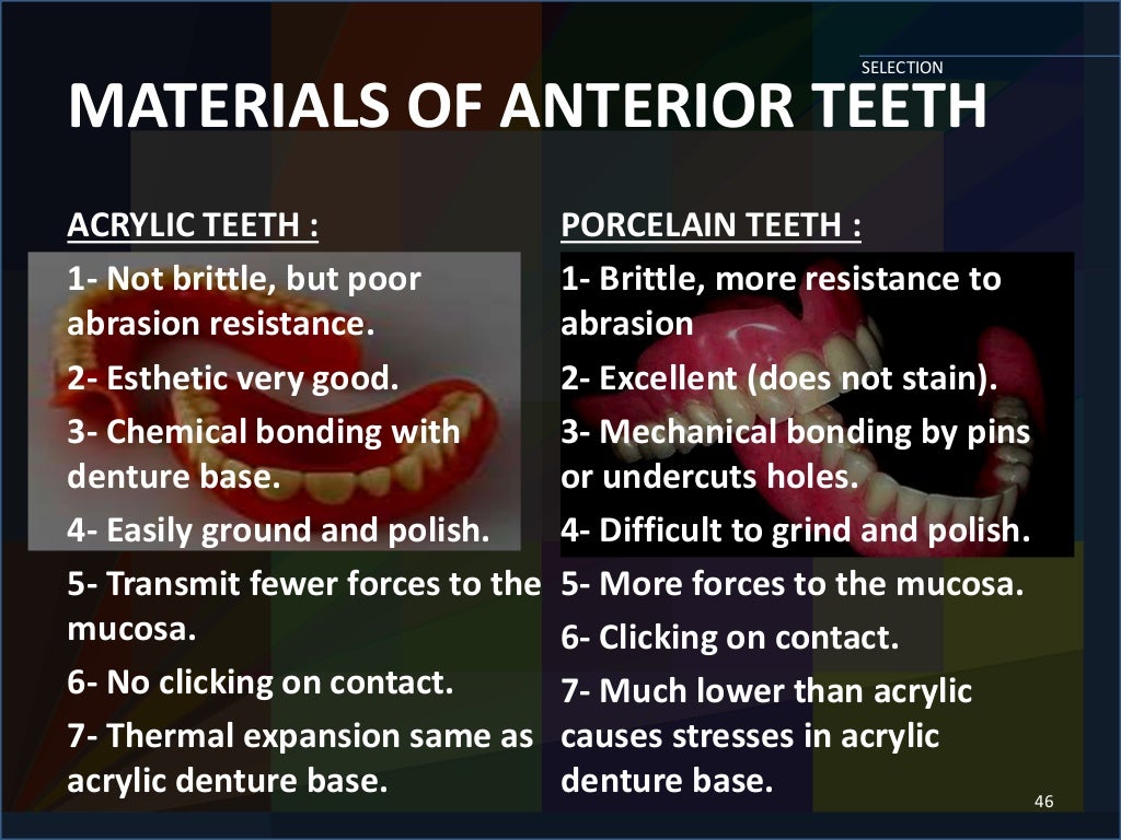 SELECTION AND ARRANGEMENT OF ARTIFICIAL TEETH